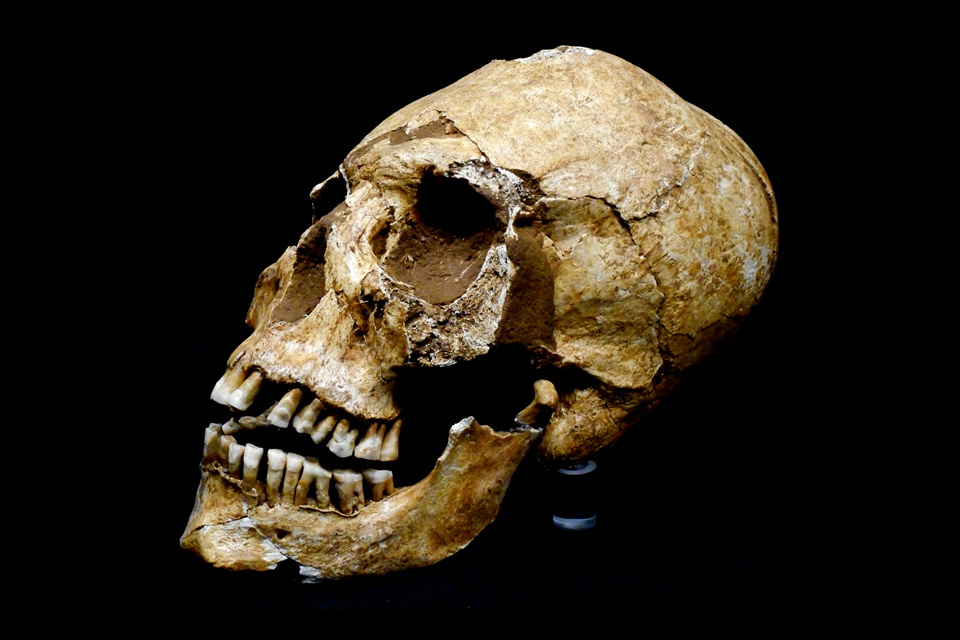 Elongated Skull from Collegno 6th century. Source: Wikipedia