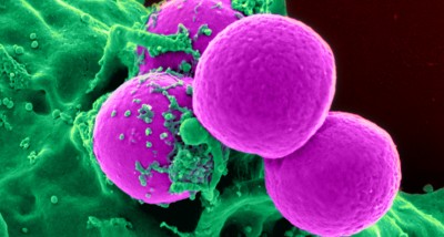 MRSA Bacterias