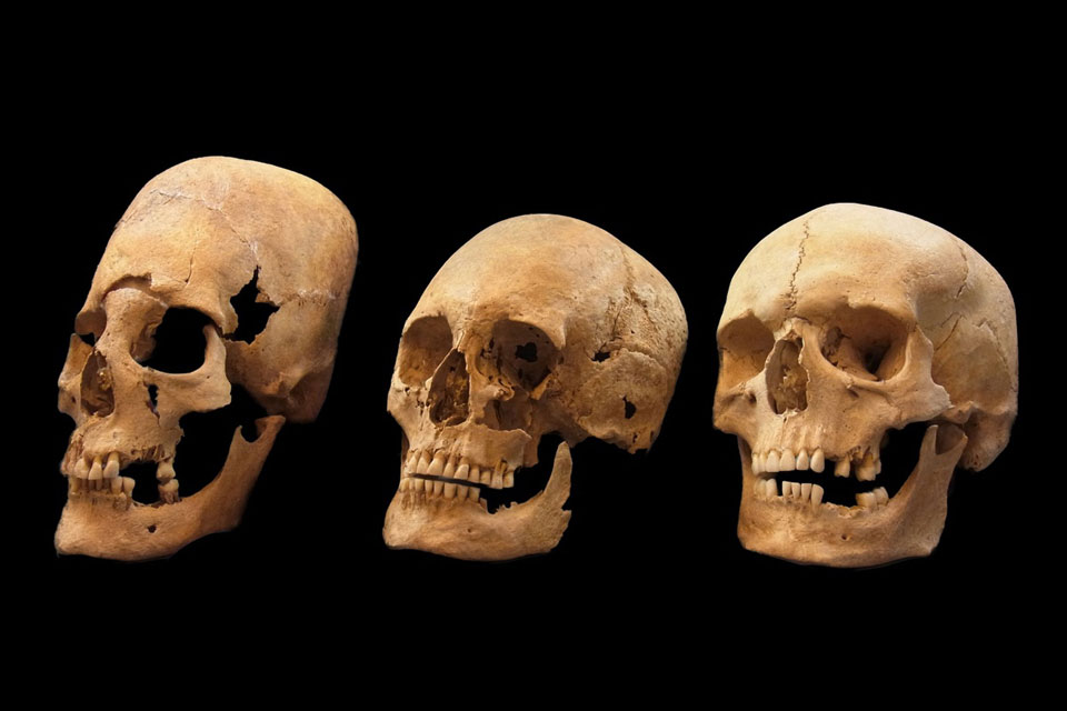Elongated and deformed skulls from Altenerding © State collection for Anthropology and Paleoanatomy Munich, Germany