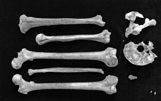 Gokstad Man. Source: Skjelettet fra Gokstadskipet – ny vurdering av et gammelt funn. By Per Holck. Michael 2008, Vol 4.