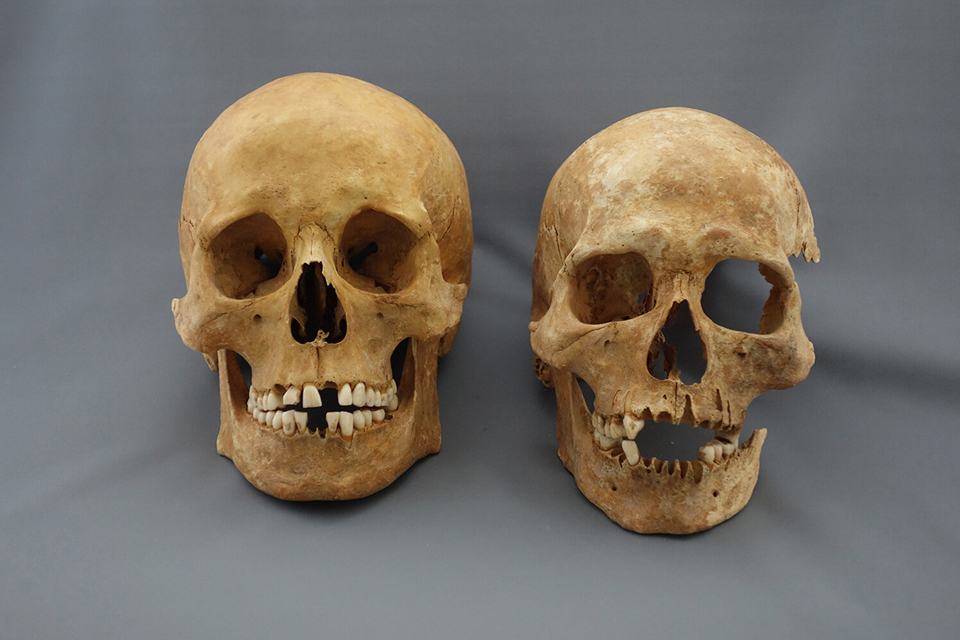 Plague Victims. Credit: M. Schweissing. © Statssammlung für Antropologie, München