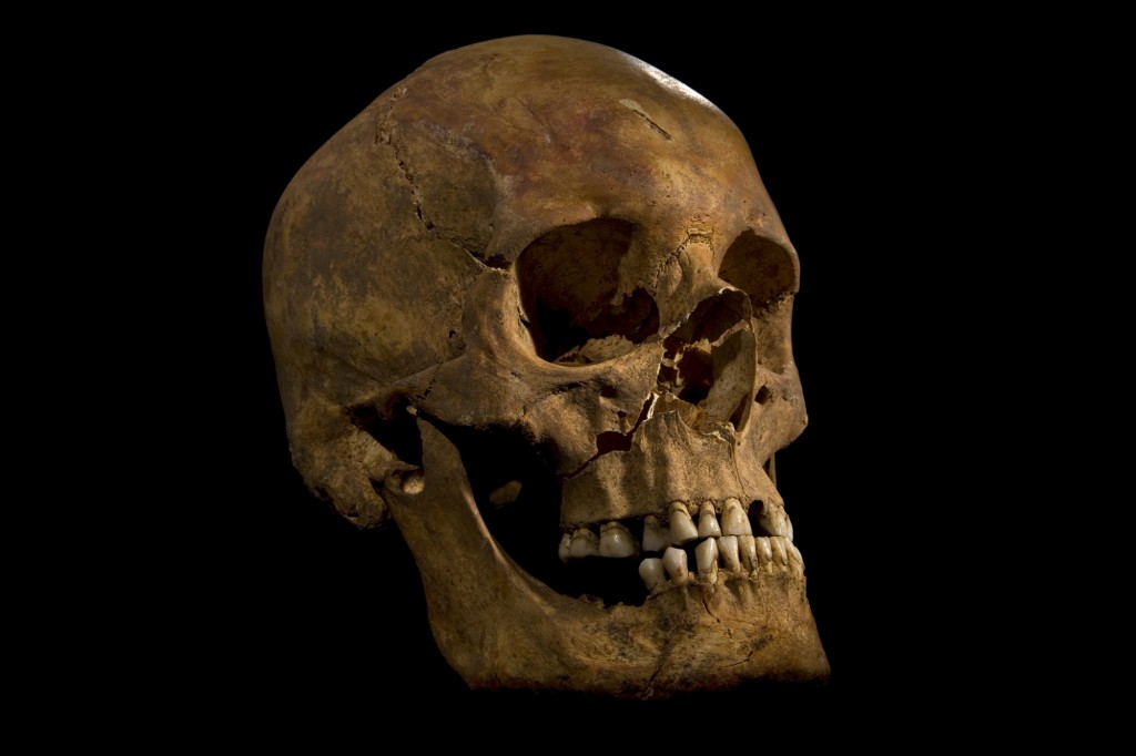 The Skull of Richard III - Leicester University ©