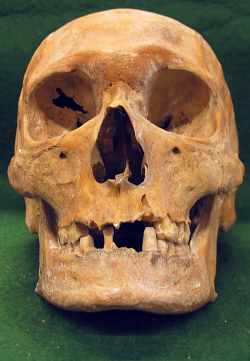 Sven Estridsson skull